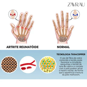 Artrite Gloves – Luvas de Compressão